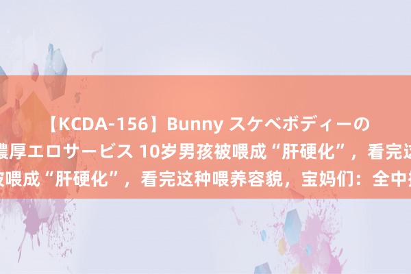 【KCDA-156】Bunny スケベボディーのバニーガールが手と口で濃厚エロサービス 10岁男孩被喂成“肝硬化”，看完这种喂养容貌，宝妈们：全中招了